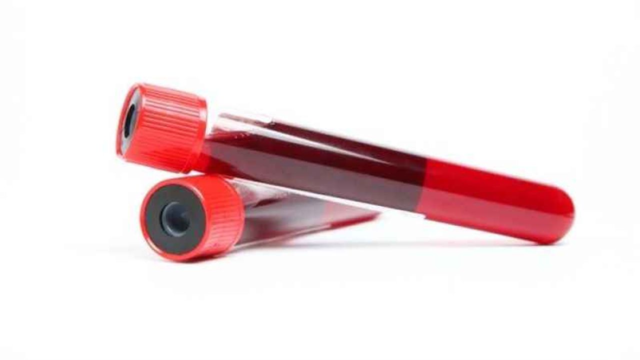 Tahlil sonuçları kaç günde çıkar?