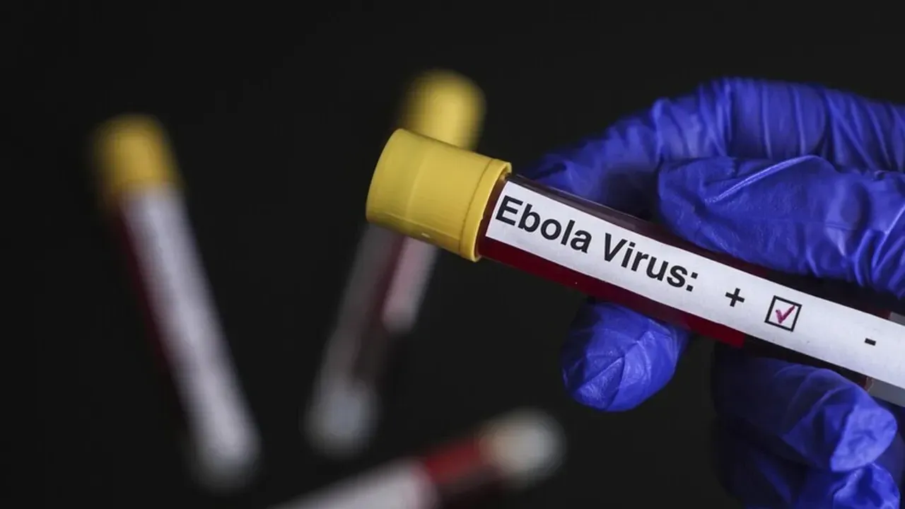 Avrupa'da Ebola alarmı! Belçika'dan acil durum ilanı