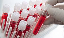 Dünyanın en nadir kan grubu! Sadece belli sayıda, sınırlı kişide var