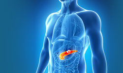 Pankreas’ta Yeni Umut: Ire Yöntemi! Pankreas Kanserinin 10 İşaretine Dikkat!