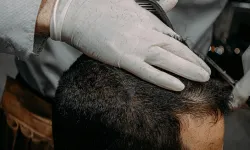 Kellikte devrim! Bilim dünyasında heyecana neden olan araştırma