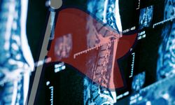 Belim ağrıyor diye korkmayın, bu belirtiler yoksa şansılınız