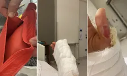 İstanbul’da sıcak su torbası patladı: Genç kızın vücudunun yüzde 25’i yandı