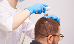 Saç ekimi İstanbul: Dünyanın yeni saç restorasyon başkenti