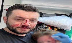 Kucağındaki bebeğiyle darp edilen baba saldırganın serbest bırakılmasına isyan etti