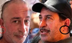 Kulak memesindeki çizgi kalp krizi habercisi mi, Frank işareti neden oluşur, kimlerde görülür?