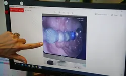 Çocuklarda yabancı cisim yutma vakaları artıyor! Uzmandan ailelere pil ve mıknatıs uyarısı