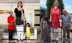 Rümeysa Gelgi kimdir, kaç yaşında, nereli, boyu kaç? Dünyanın en uzun kadınının hastalığı, mesleği ve Guinness rekorları