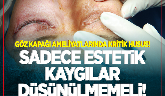 Göz kapağı ameliyatlarında kritik husus! Sadece estetik kaygılar düşünülmemeli...Göz kuruluğu veya gözde yorgunluk varsa!..