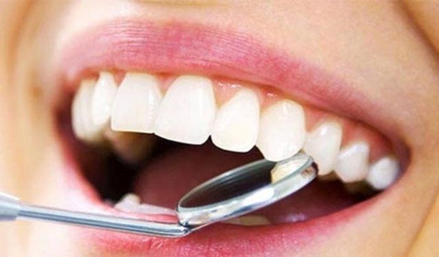 Doku Clinic’te Diş Estetiği Yaklaşımı: Hollywood Smile ve Gülüş Estetiği Rehberi