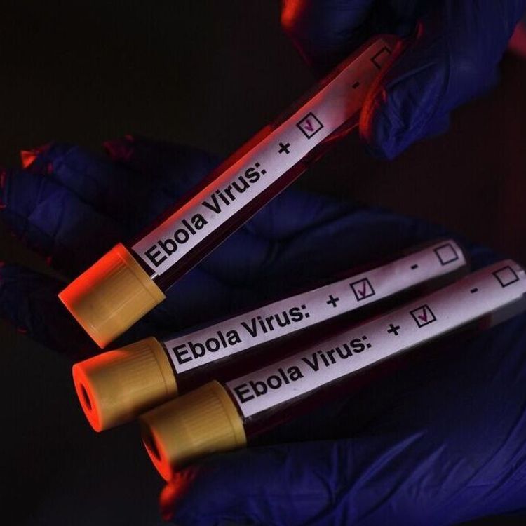Dünyayı korkutan rapor: Ebola salgınında vaka sayısı 20 bini aşabilir!