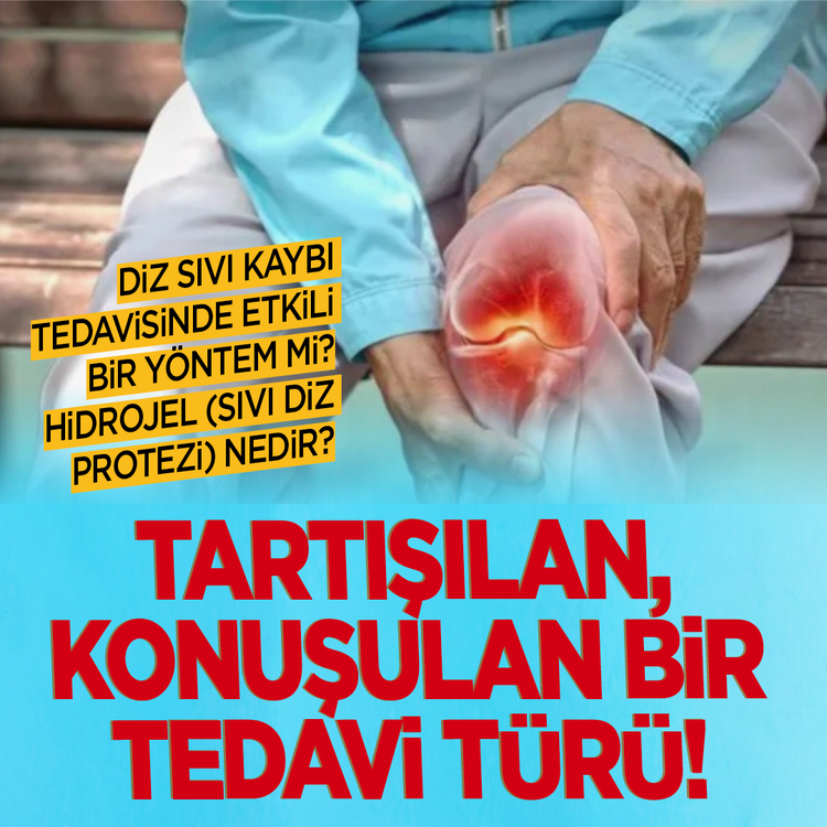 Diz sıvı kaybı tedavisinde etkili bir yöntem mi? Hidrojel (sıvı diz protezi) nedir? Tartışılan, konuşulan bir tedavi türü!