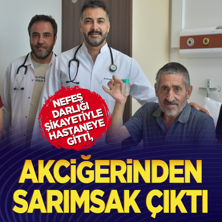 Nefes darlığı şikayetiyle hastaneye  gitti: Akciğerinden sarımsak çıktı