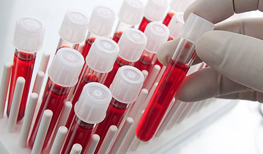 Dünyanın en nadir kan grubu! Sadece belli sayıda, sınırlı kişide var