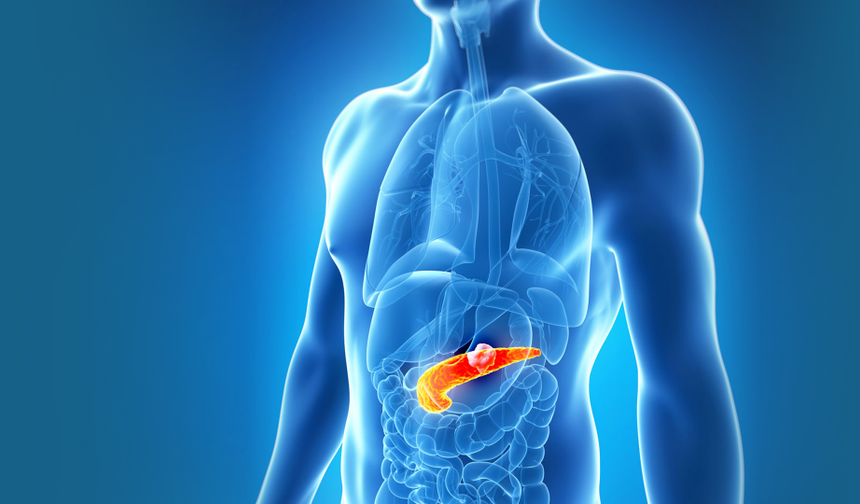 Pankreas’ta Yeni Umut: Ire Yöntemi! Pankreas Kanserinin 10 İşaretine Dikkat!