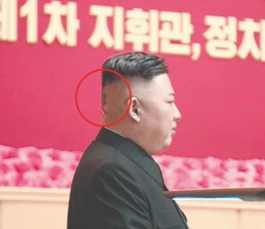 Kim Jong-Un'un o eski halinden eser yok -3
