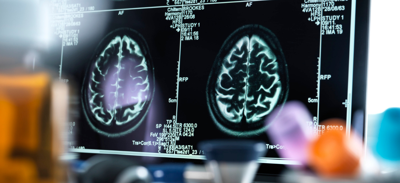 Beyninizin Gizli Haritası Çıkarıldı Hangi Yaş Daha Verimli İşte 4 Kritik Kırılma Noktası...s