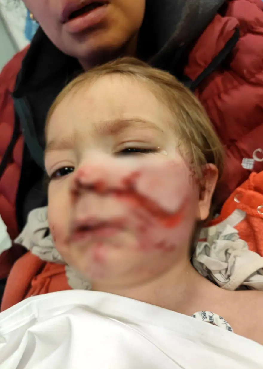 A N K A R A D A 2 K A R D E S E S A L D I R A N P I T B U L L V E 1041852 309134 544393