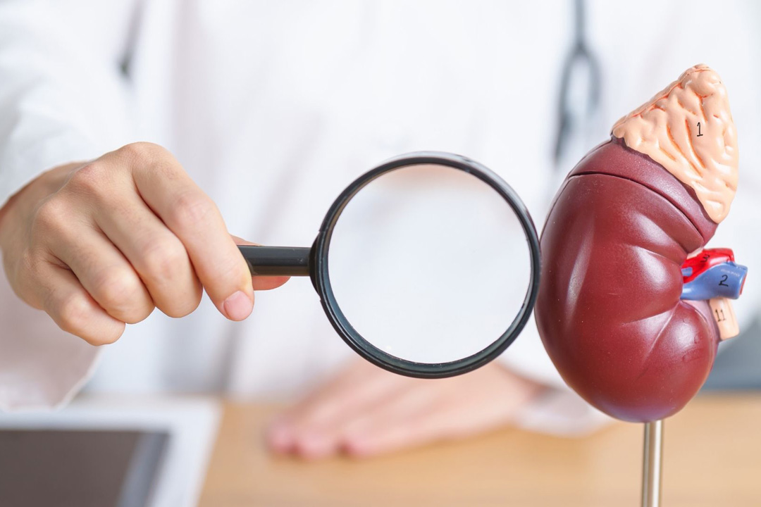 Tıp Dünyasını Sarsan Olay Kokarca Tırmalaması Organ Nakliyle Ölüme Götürdü!S