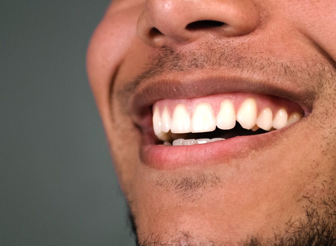 Doku Clinic’te Diş Estetiği Yaklaşımı Hollywood Smile Ve Gülüş Estetiği Rehberi