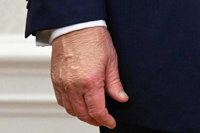 Trump Sağlık Kontrolünden Geçecek 80 Yaşına Giriyor (1)-2
