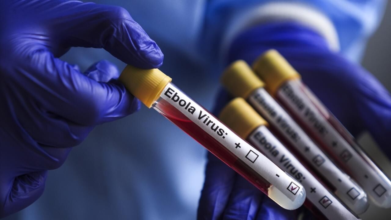 Afrika'da Ebola Alarmı! Aşısı Ve Tedavisi Yok O Ülke Teyakküza Geçti!J