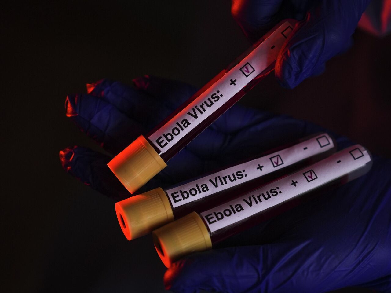 Afrika'da Ebola Alarmı! Aşısı Ve Tedavisi Yok O Ülke Teyakküza Geçti!V