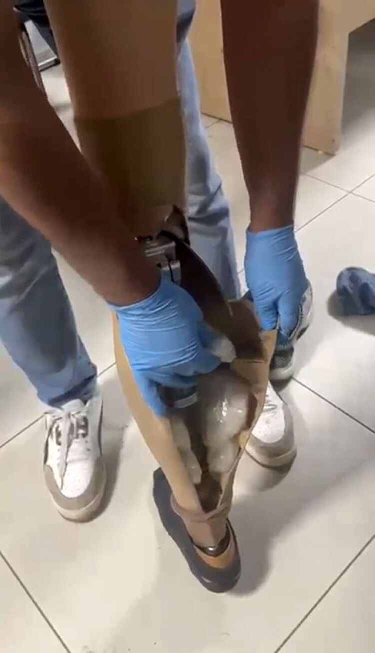 Protez Bacağına Gizlediği Uyuşturucu Ile Yakalandı!S (2)