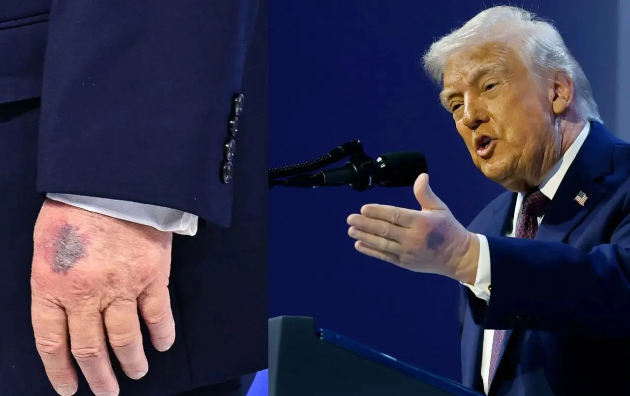 Trump, Yine Morarmaya Başladı Makyaj Yaptığını Kabul Etti!S-1
