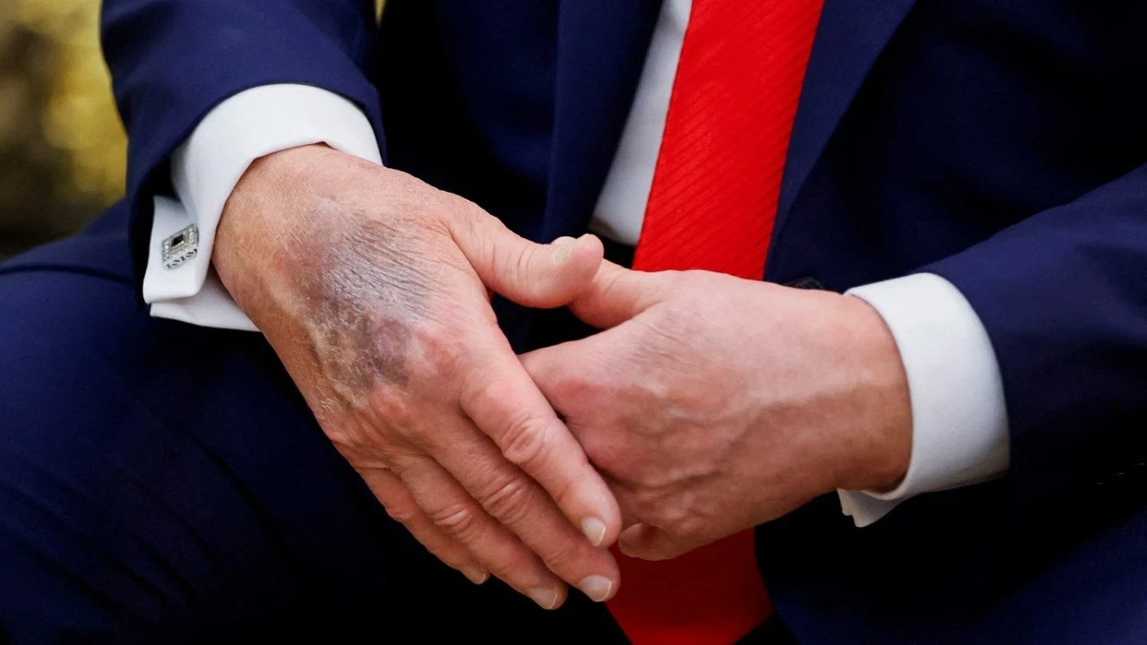 Trump, Yine Morarmaya Başladı Makyaj Yaptığını Kabul Etti!S