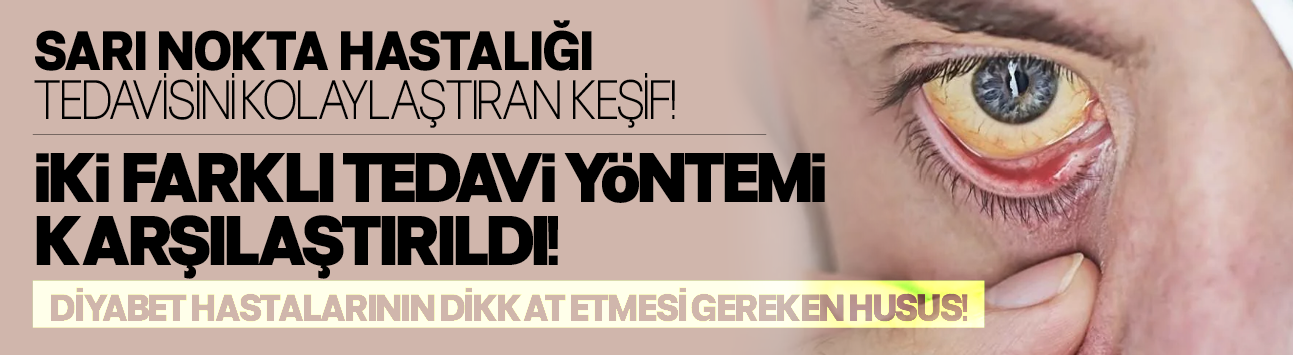 Sarı nokta hastalığı tedavisini kolaylaştıran keşif: İki farklı tedavi yöntemi karşılaştırıldı