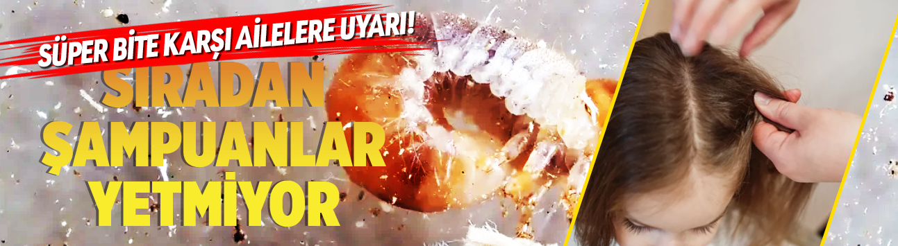 Süper bite karşı ailelere uyarı! Sıradan şampuanlar yetmiyor