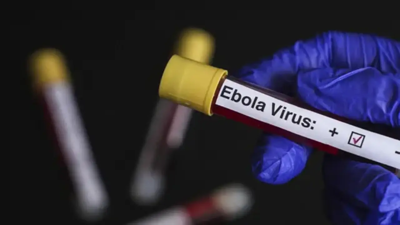 Bir Ülkede Ebola Virüsü Paniği! Ebola Virüsü Nedir, Türkiye'de Ebola Virüsü Riski Var Mı (1)-2